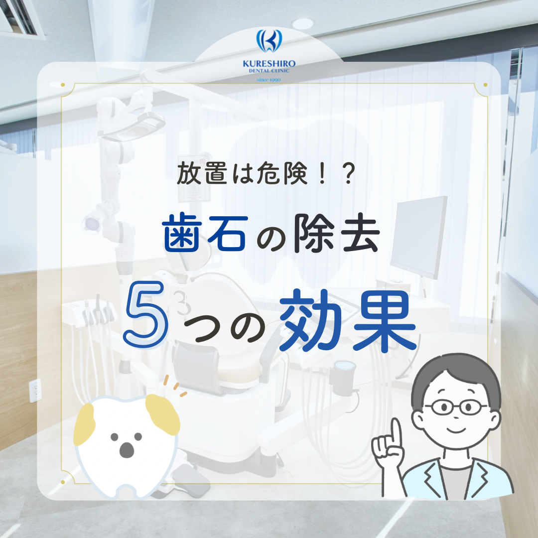 歯石の除去5つの効果