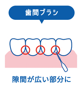 歯間ブラシの特徴