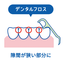 デンタルフロスの特徴