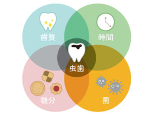 むし歯はなぜできるのか