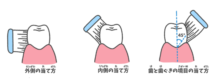 正しい歯ブラシの当て方