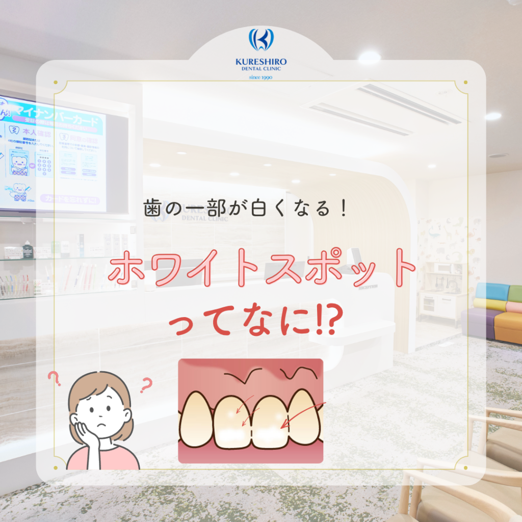歯の一部が白くなる！ホワイトスポットってなに！？